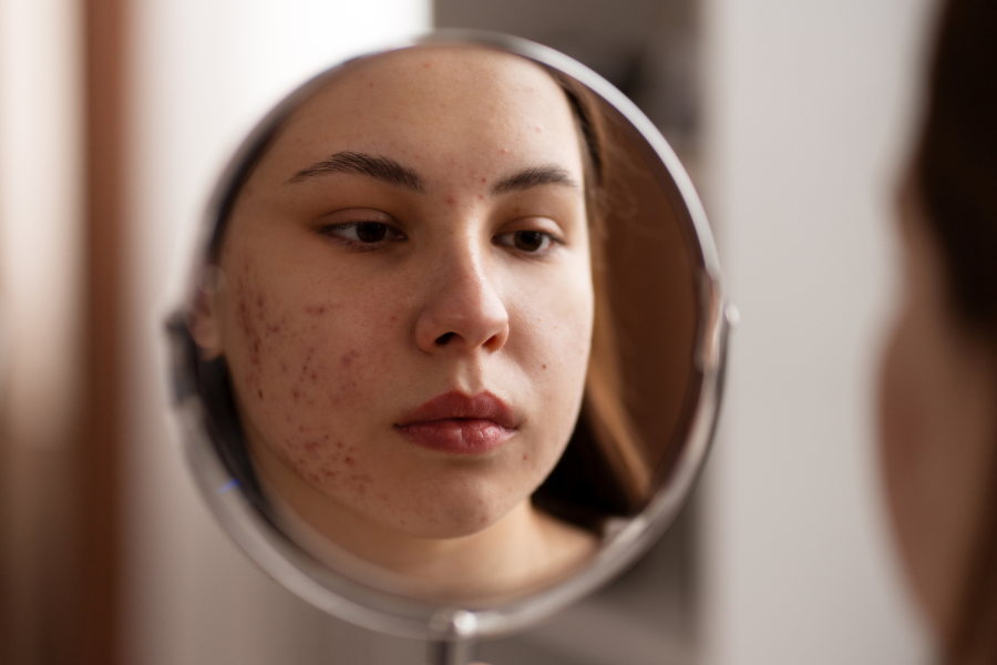 rekomendasi skincare untuk kulit sensitif