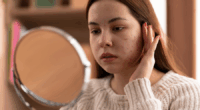 skincare untuk kulit sensitif