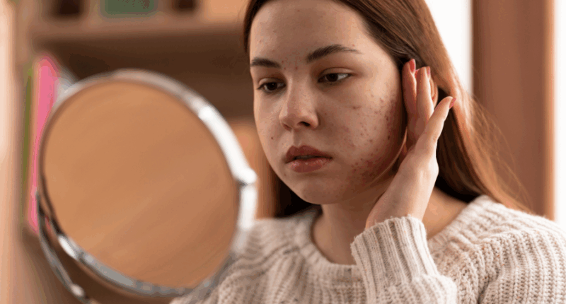skincare untuk kulit sensitif